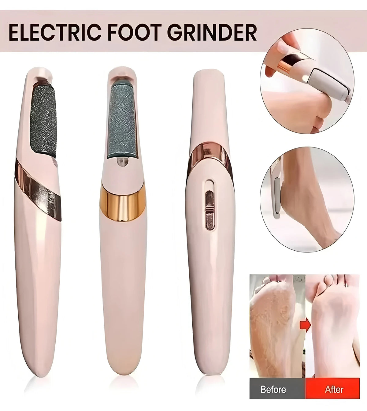 Cordless Rechargeable Electric Callus Remover, Foot File for Dry Coarse Skin Removal on